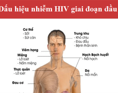 CHĂM SÓC NGƯỜI NHIỄM HIV