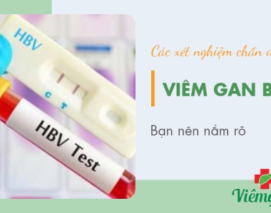 CÁC XÉT NGHIỆM CHẨN ĐOÁN VIÊM GAN B PHỔ BIẾN NHẤT