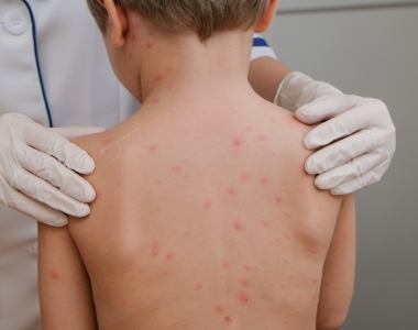 MÙA THỦY ĐẬU ĐANG ĐẾN GẦN